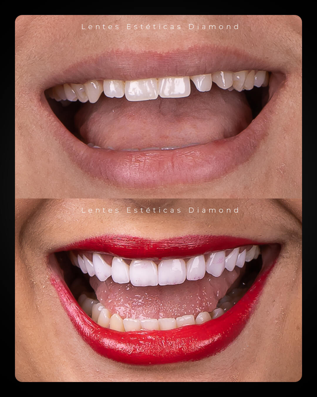 Diamond_post_feed_antes_depois-_FABIANA---Cintya-da-Silva