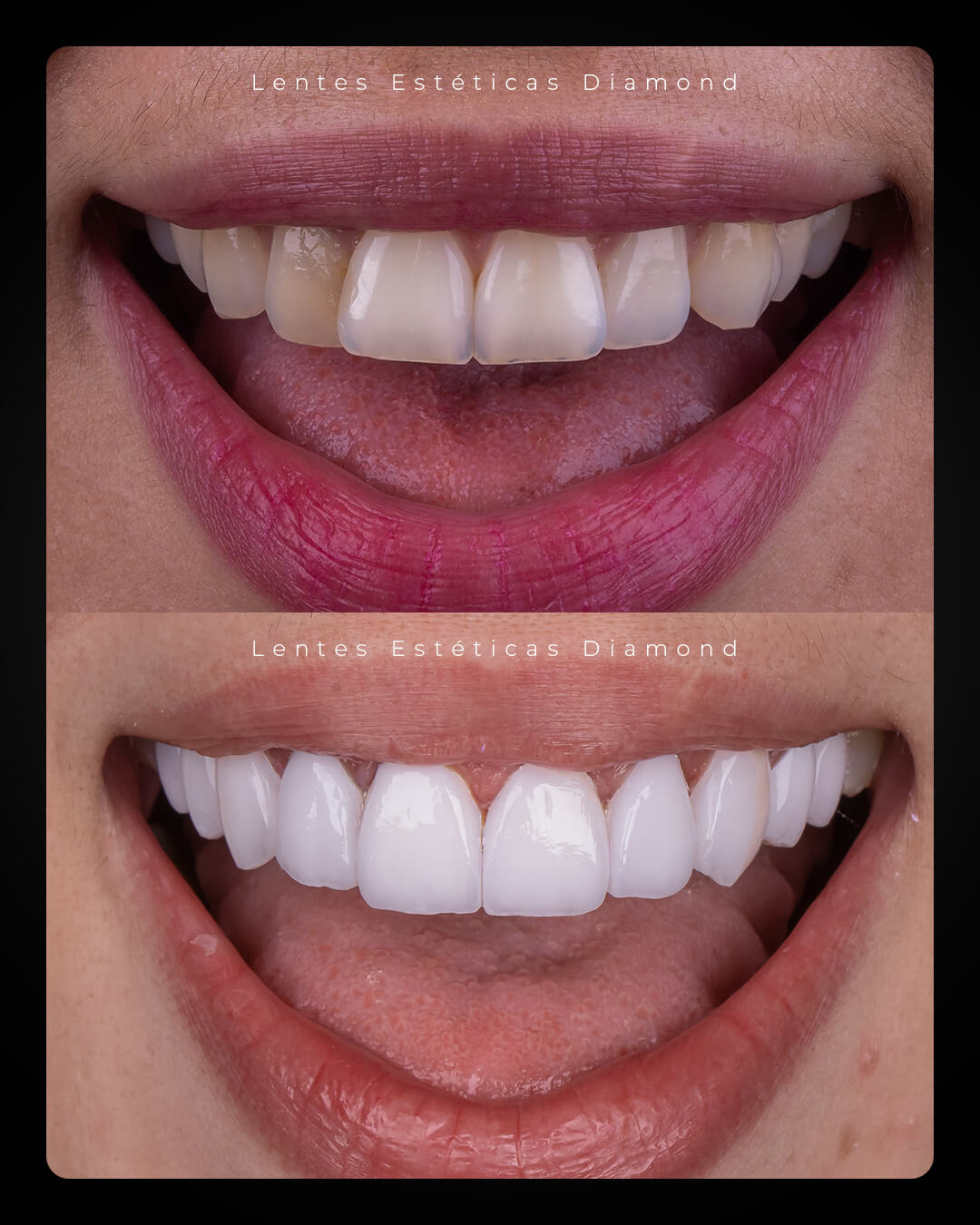 Diamond_post_feed_antes_depois-_FABIANA---Debora-Novais