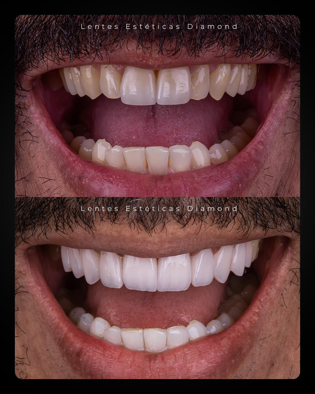 Diamond_post_feed_antes_depois-_FABIANA---Osias-Ferreira